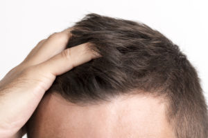 7 Top Tips For Guys With Fine and Thinning Hair  Mens Hair