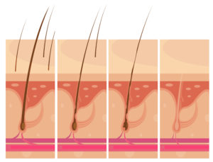 Concepto de Piel con pérdida de cabello