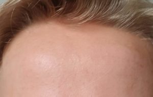 After Application